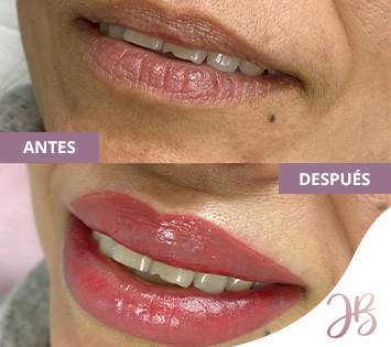 Micropigmentacin de Labios Antes y Despus