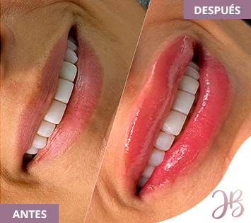 Micropigmentacin de Labios Realizada por Joa Paba