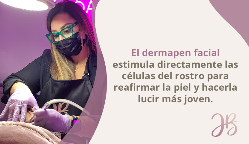 Mujer Muestra Resultados del Dermapen Facial