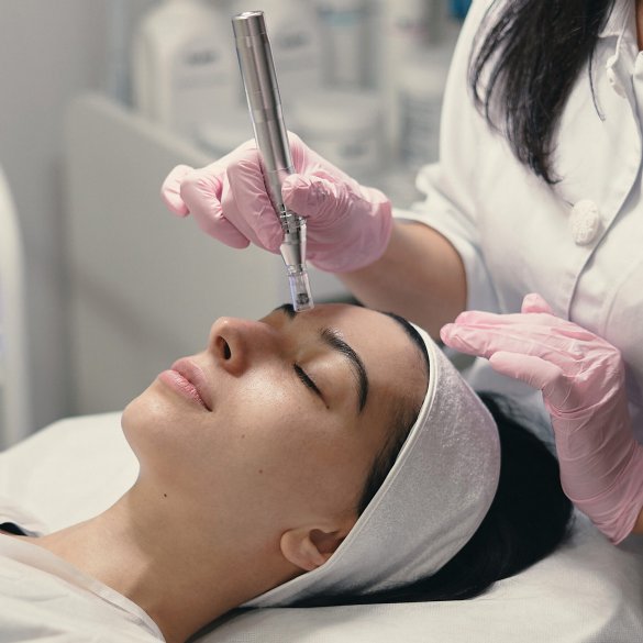 Dermapen Facial